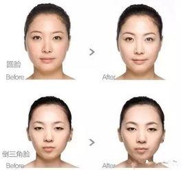 明星网红瘦脸针图片,效果惊人，副作用知多少？
