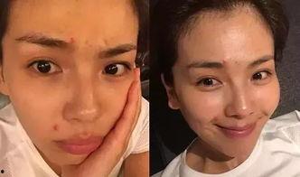 明星网红长痘图片女,揭秘长痘背后的护肤真相