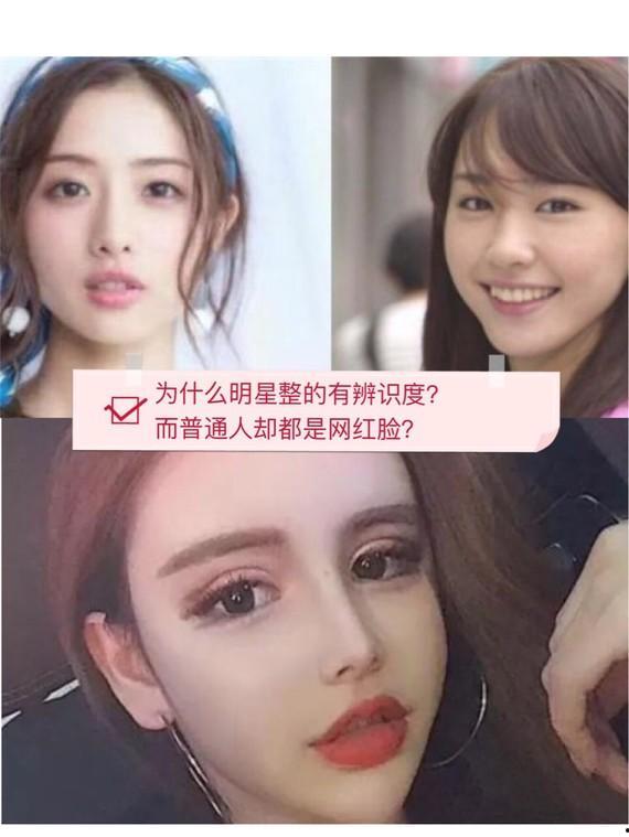 明星网红整形事故案例,明星案例揭示美容风险