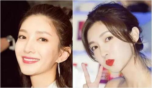 明星网红整形事故案例,明星案例揭示美容风险