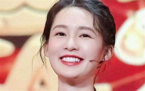 明星网红牙贴面图片高清,美丽笑容的秘密武器