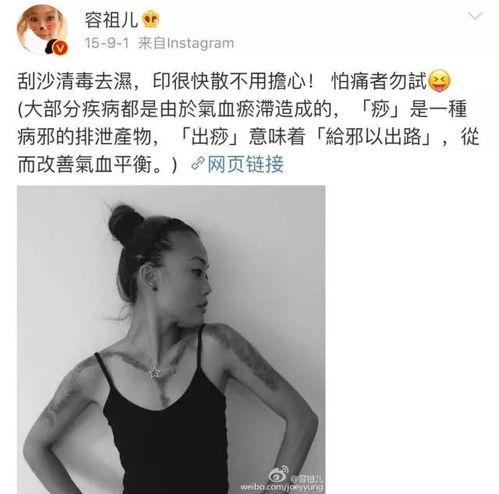扎针的明星网红是谁,揭秘扎针网红的走红之路