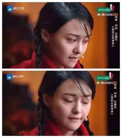 嘴上有疤痕的明星网红,揭秘嘴上疤痕的明星网红