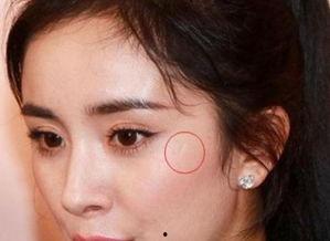 嘴上有疤痕的明星网红,揭秘嘴上疤痕的明星网红