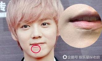 嘴上有疤痕的明星网红,揭秘嘴上疤痕的明星网红